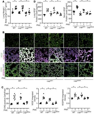 Inhibition of angiogenesis and regenerative lung growth in Lepob/ob mice through adiponectin-VEGF/VEGFR2 signaling